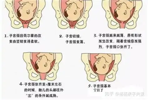 生孩子头高靠上可以顺产吗