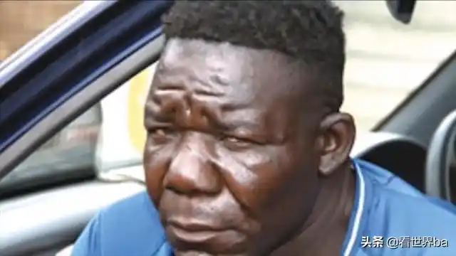 非洲"最丑"的人,5次选丑4次夺冠,看完有些吃不下饭_网易订阅