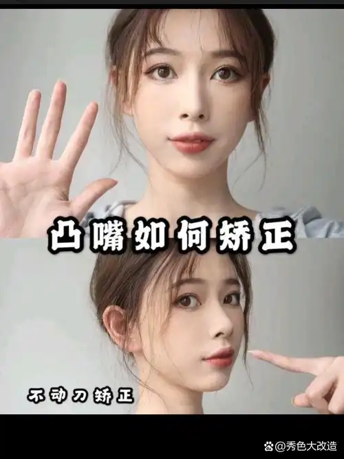 95 br>给大家分享一下科学矫正口呼吸的方式 br>991骨性凸嘴(龅牙