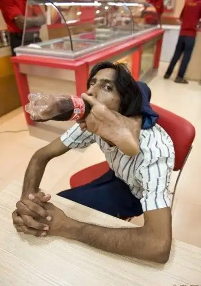 印度惊现橡胶人 — 未解之谜网