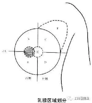 这样就将乳房分为内上,内下,外上,外下四个象限,即四个分区