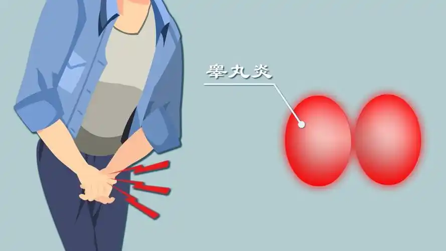 在睾丸炎治愈前,是不建议患者进行性生活的,因为有可能会将炎性病菌