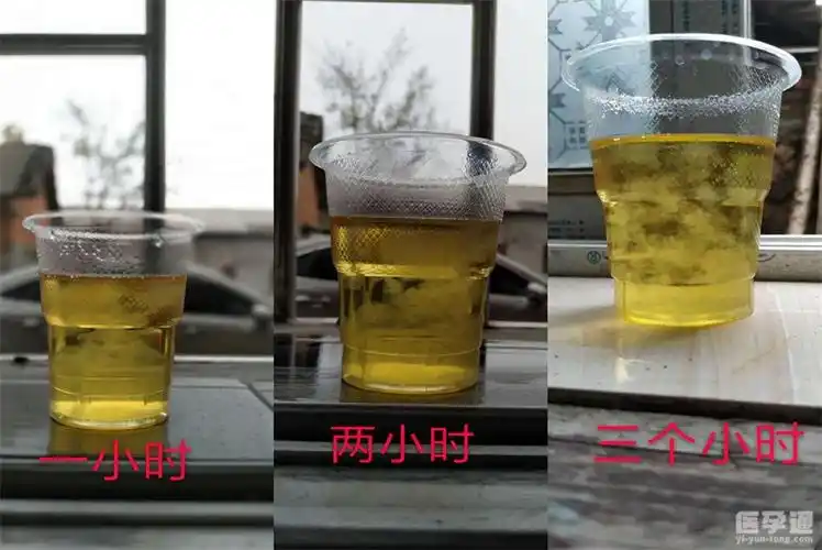 75酒精测男女图片结果分层沉淀物见分晓