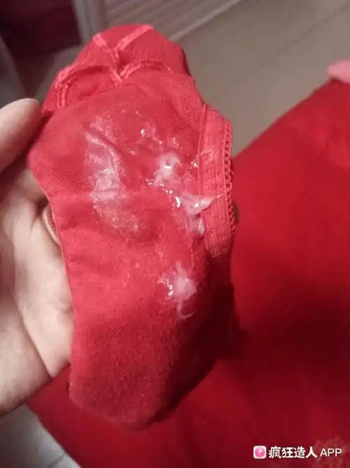早上起来发现内裤上好多酸奶状白带