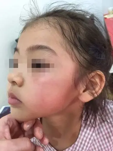 家长护犊掌掴对方小孩致脸肿被拘留 监控令人揪心