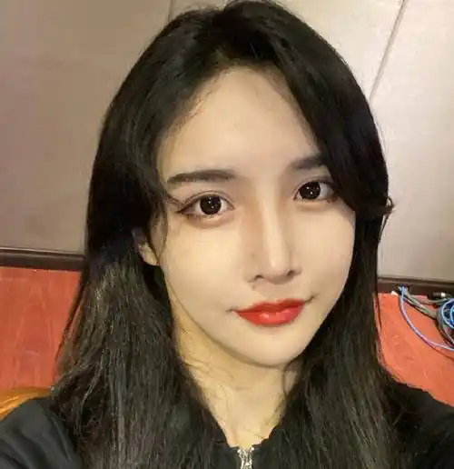 艾比为了热度晒出素颜照早上醒来脸部浮肿严重明显的整容过度