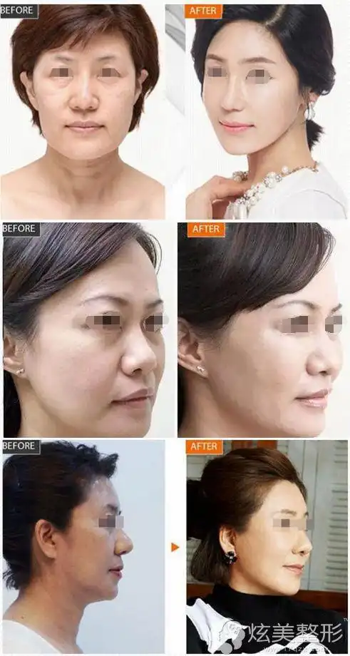 龚斌主任多年的经验指出线雕不仅要看价格更要看效果