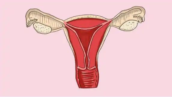 子宫下垂是什么