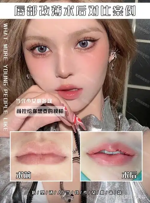 微笑唇 - 知乎