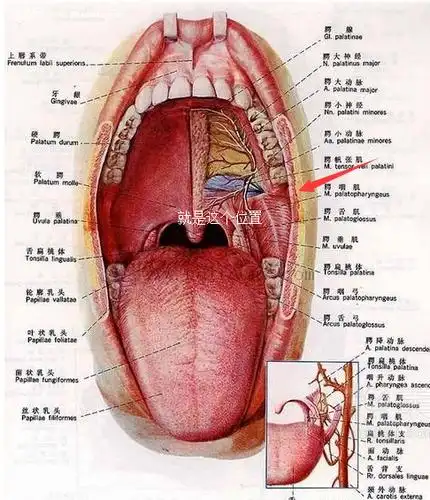 男,23岁,上个月长了几个口腔溃疡,过阵子其他的都好了,但在上颚左侧最