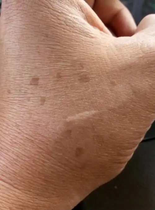 手上老年斑图片 老年斑是怎么长的 – 历史趣闻网