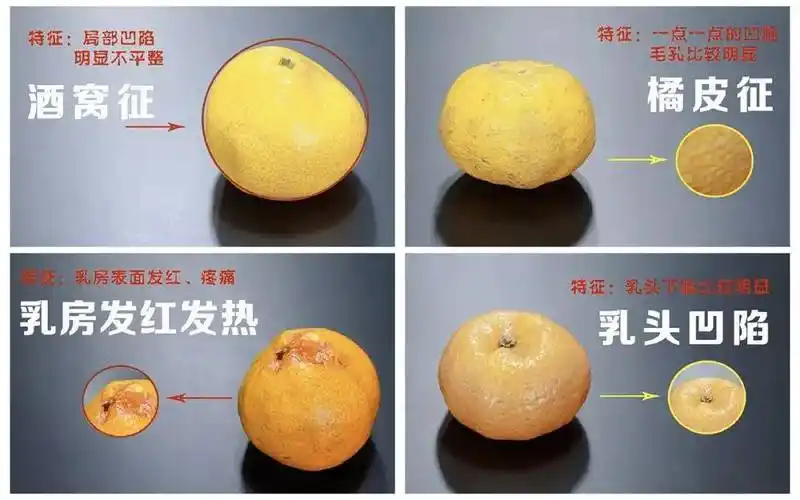 创意绝绝子甲乳外科女博士用4个橘子演示乳腺癌危险信号