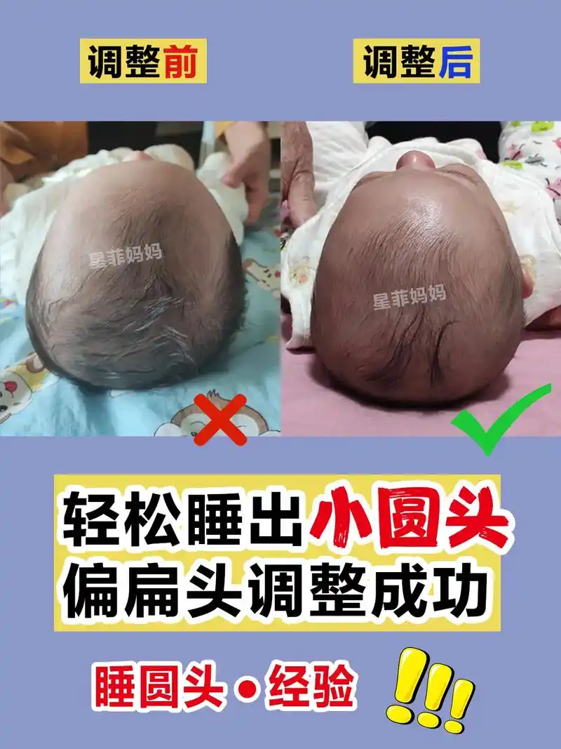 偏扁头睡圆头9215宝宝睡圆头.