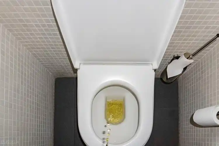 怀男孩的晨尿颜色(男性晨尿和疾病有关联) - 乐宝宝贝