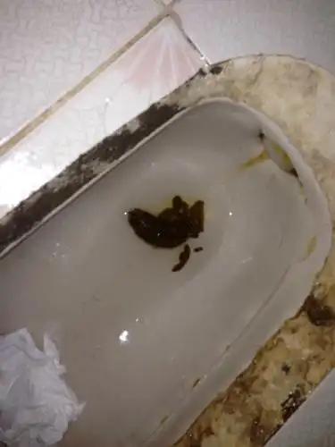 对不起,有点恶心.这个大便颜色正常么?