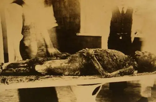 日军731部队活体解剖罪证