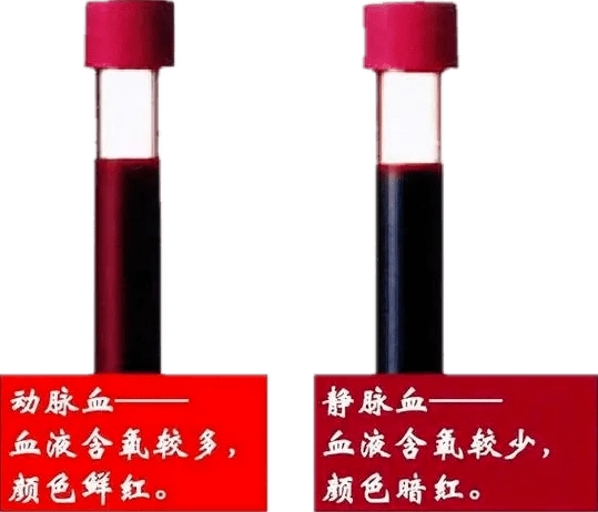 比颜色:动脉血里面血氧含量较多,因此呈鲜红色,其内还有很多的营养