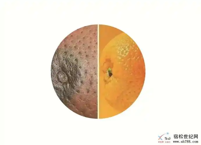 2020年第26个全国肿瘤防治宣传周:预防乳腺癌