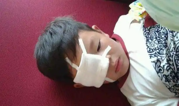 孩子眼睛迷进石灰险些"失明",3点让娃掌握安全意识,可别忽视