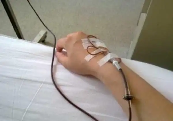 输血有风险 输血需谨慎