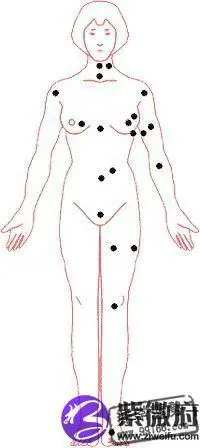 你的私密有痣好不好?