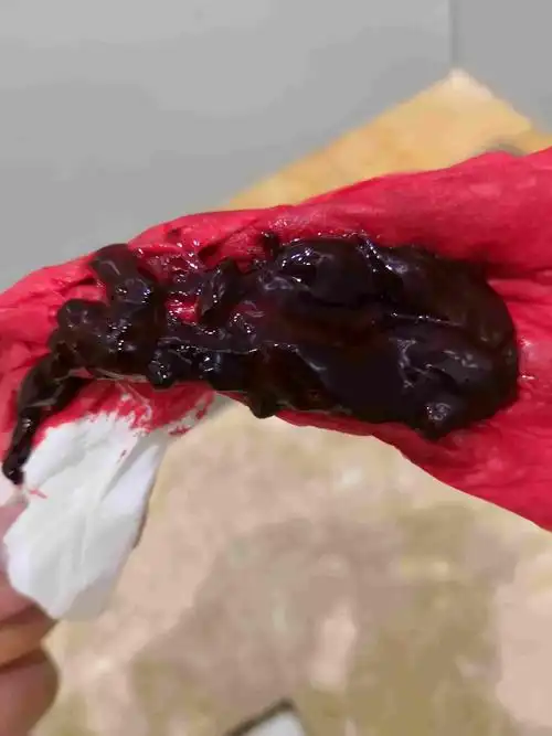 月经血块图片哪种正常?-图片大观-奇异网