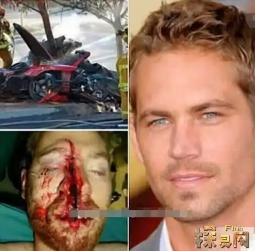保罗沃克车祸事件始末困在车内被活活烧死面部照曝光2