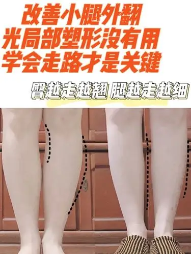 小腿外翻不能只靠局部训练学会走路才重要7575