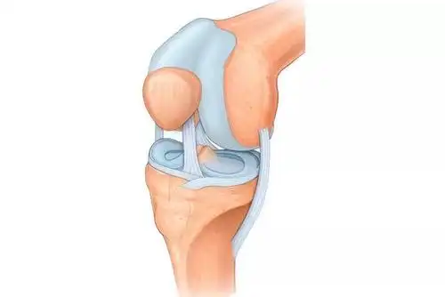 半月板损伤,如何治?如何避免加重?