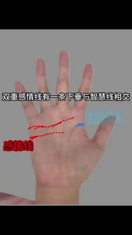 双重感情线有一条下垂与智慧线相交