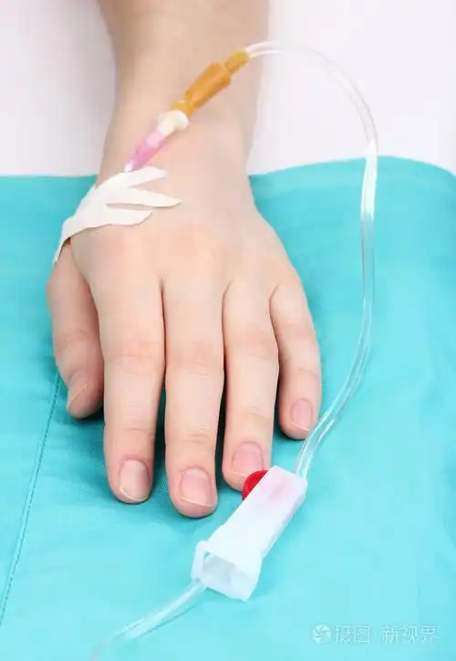 输液的女性手臂