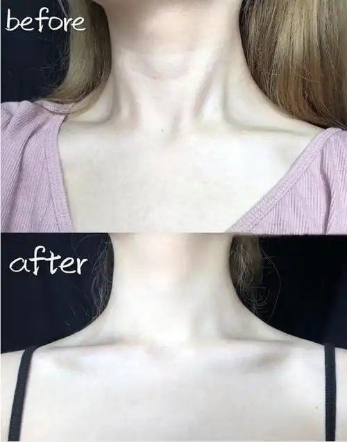 女人脖子出现"3道杠",你知道意味着什么吗?早知道早好!