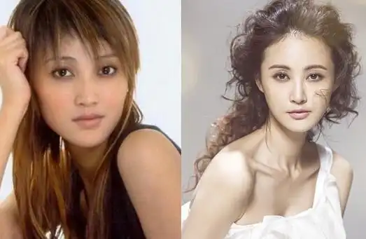 张歆艺整容前后照片 面容僵硬整容痕迹明显从圆脸变成了锥子脸