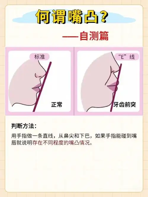 嘴凸怎么办?怎么判断是牙性还是骨性? 牙齿矫正有用吗?