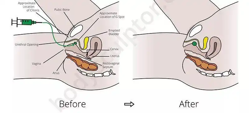 医美经|不能说的秘密?私密处保养全攻略(上)