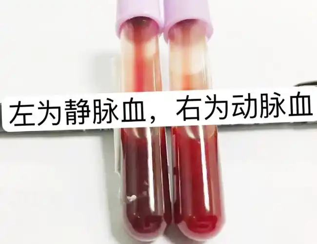 但是在有些情况下,血液的颜色会发生明显改变,这可能是某些疾病的征兆