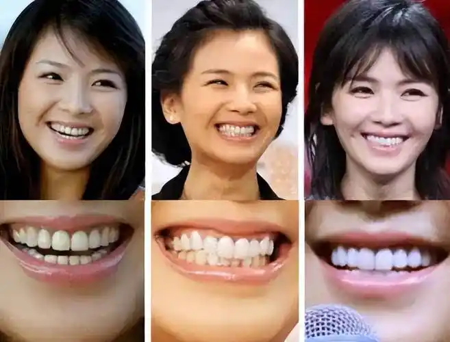 女明星"假牙"大pk,谁的嘴巴闭不上,谁的嘴里藏着一套房?