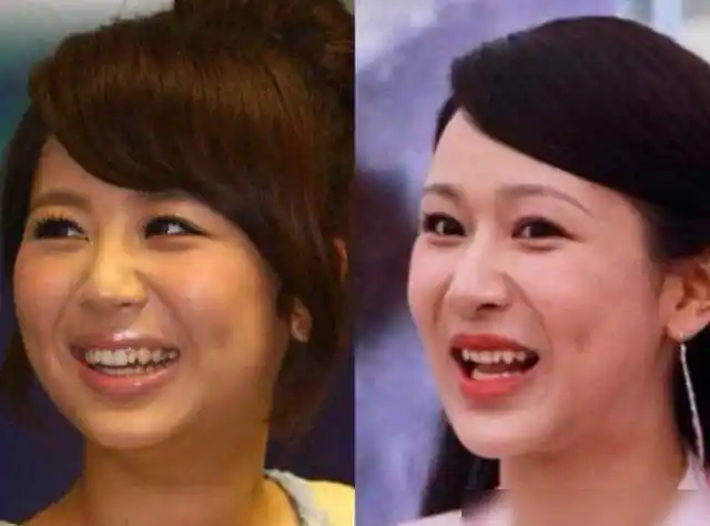 杨紫陷整容风波录向往时侧脸下巴过尖与老巫婆有一拼