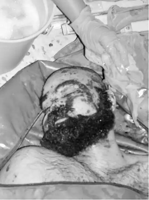 美军公布乌代 库赛尸体照片(组图)