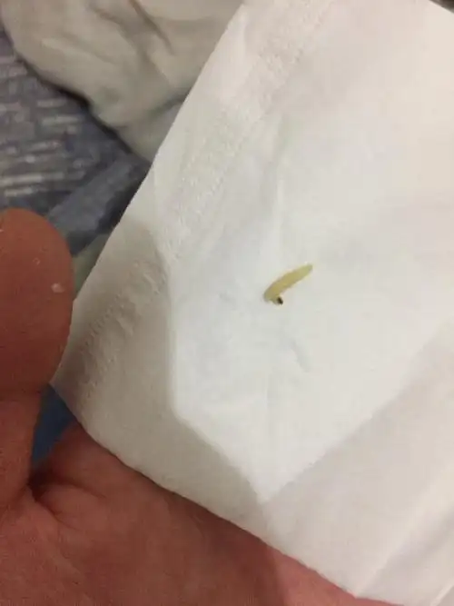 参与团队:植物爱好者 向ta提问私信ta  展开全部 这是米蛾的幼虫