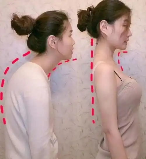 21天矫正含胸驼背让你挺胸抬头自信满满