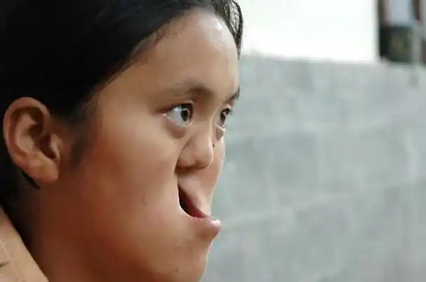 回顾农民捡到坑面女婴,哥哥做苦力为妹妹整容,变美后她嫁给哥哥