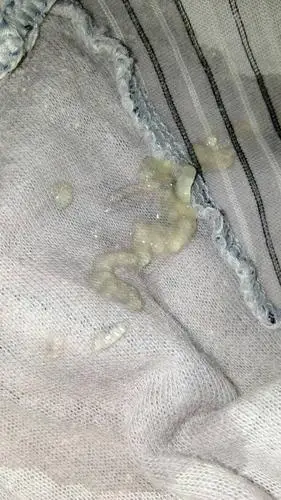 梦见遗精是什么意思遗精是