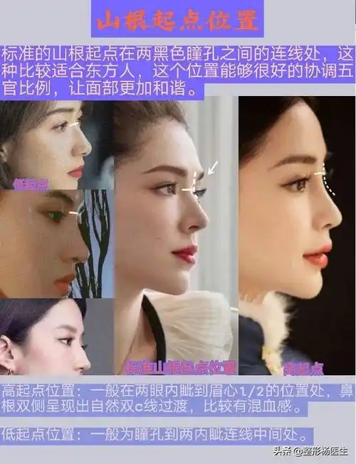 隆鼻选择焦虑症,好看的鼻子怎么选?