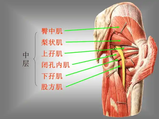 梨状肌综合征课件