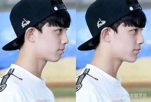 有哪些明星有颌面问题比如地包天