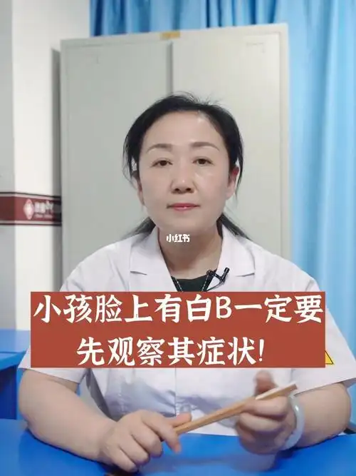 小孩脸上有白斑一定要先观察其症状