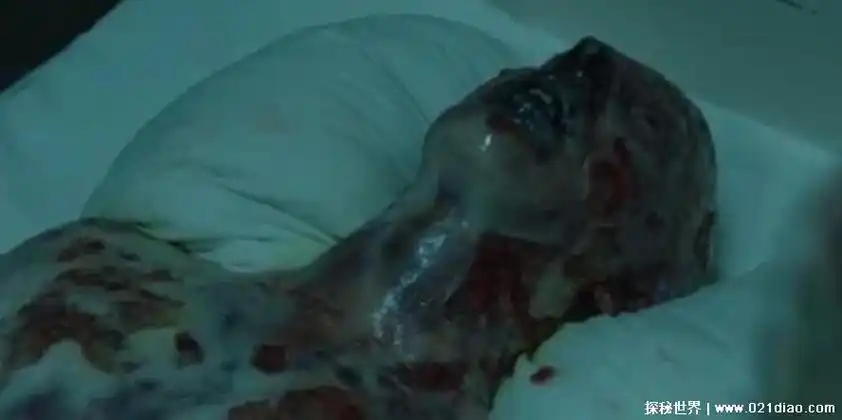 日本福岛变异物种图片 日本福岛有变异人吗