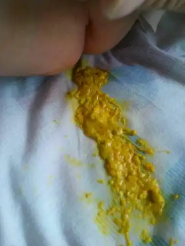 2014-06-19 李树英 医师 我家宝宝拉的便便很正常,就是排便