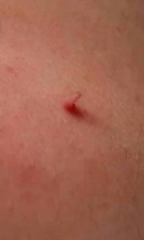 皮肤上长的是什么东西?